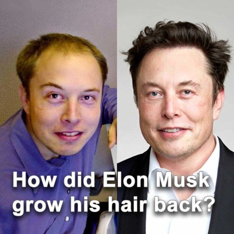 how-did-elon-musk-grow-his-hair-back-1024x1024.thumb.jpeg.6ebeb340323954da5b2c4b59053a286d.jpeg